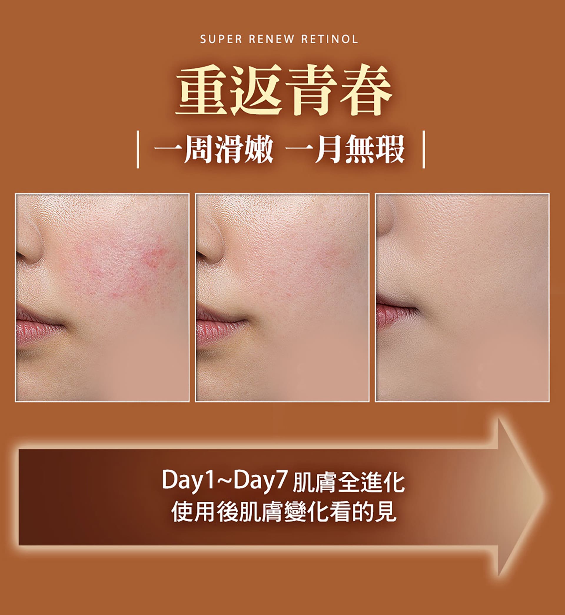 滿版banner